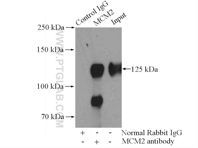 MCM2 Antibody in Immunoprecipitation (IP)