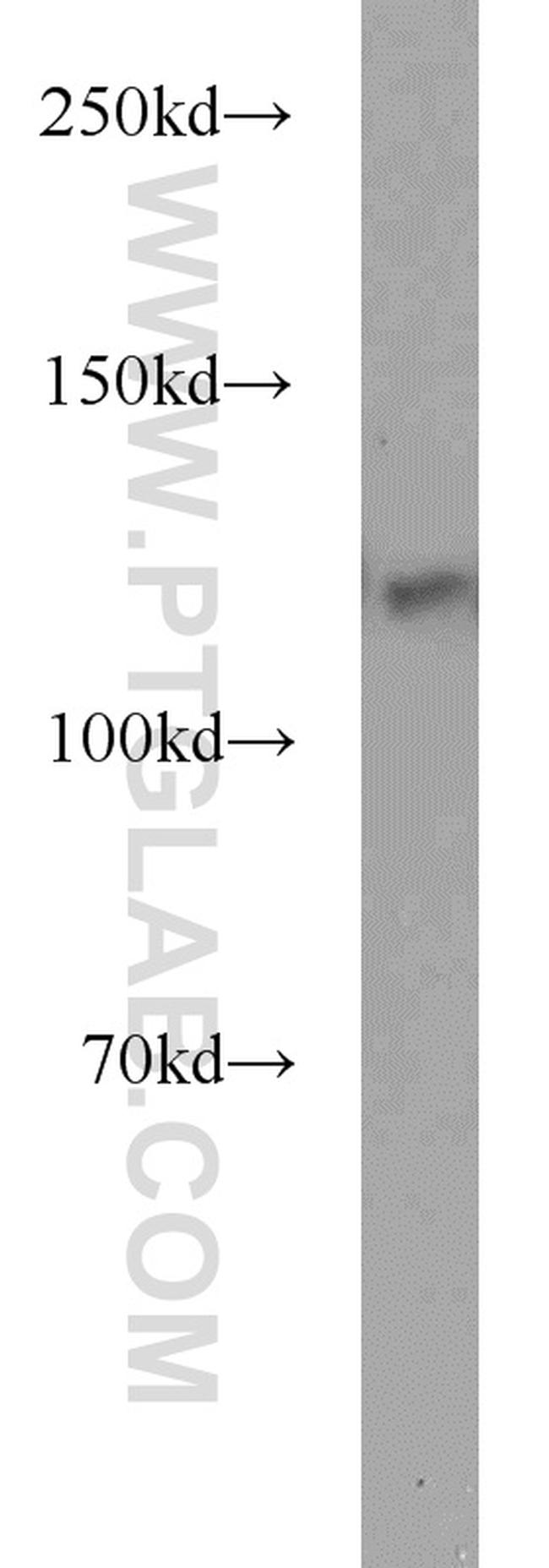 MCM2 Antibody in Western Blot (WB)