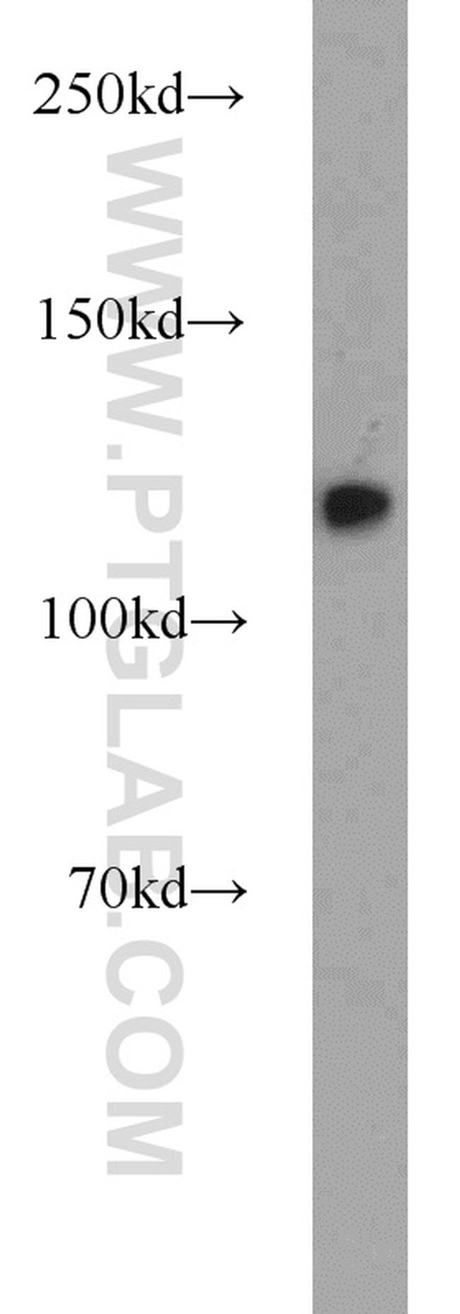 MCM2 Antibody in Western Blot (WB)