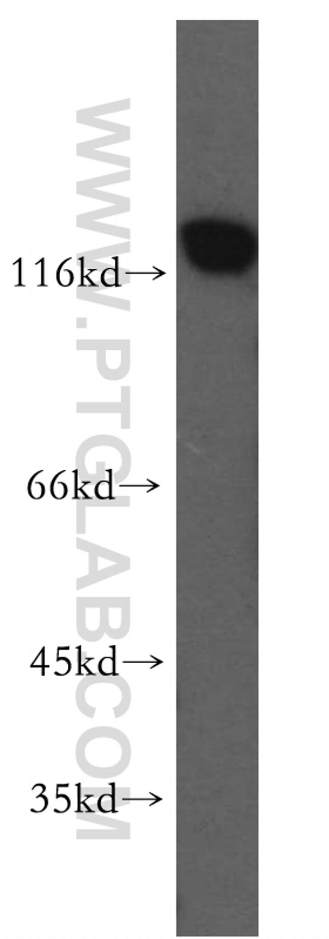 MCM2 Antibody in Western Blot (WB)