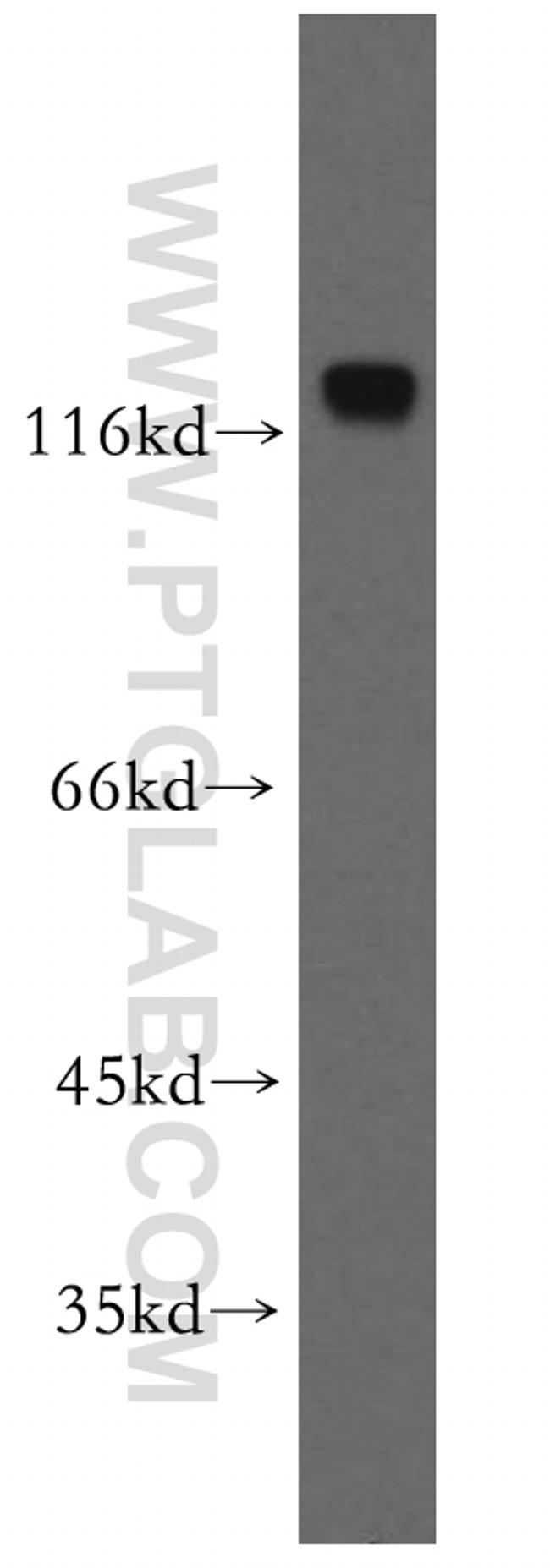 MCM2 Antibody in Western Blot (WB)