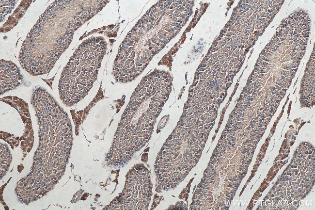 Kallikrein 5 Antibody in Immunohistochemistry (Paraffin) (IHC (P))