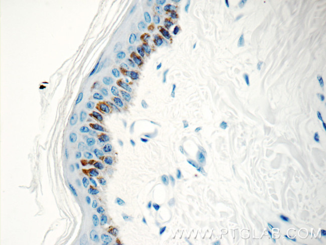 Kallikrein 5 Antibody in Immunohistochemistry (Paraffin) (IHC (P))