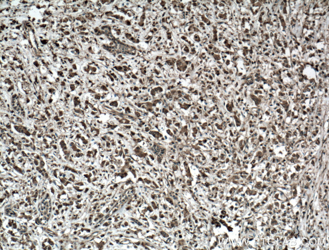 LASP1 Antibody in Immunohistochemistry (Paraffin) (IHC (P))