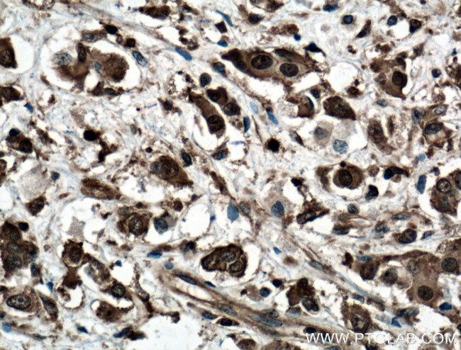 LASP1 Antibody in Immunohistochemistry (Paraffin) (IHC (P))