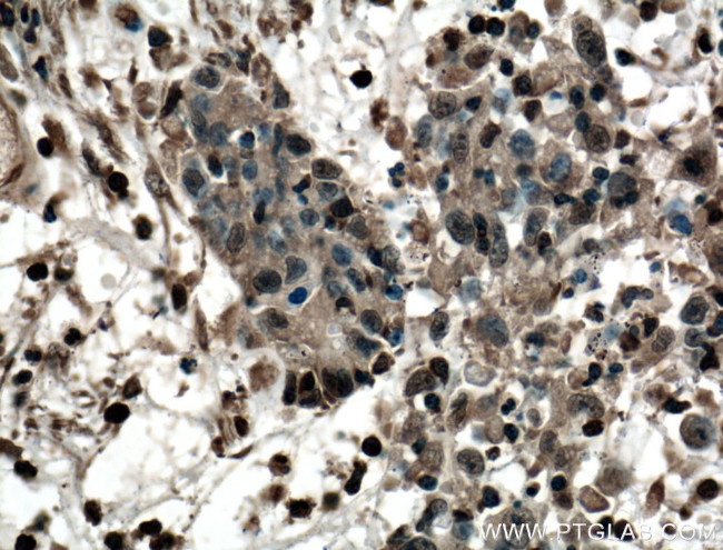 LASP1 Antibody in Immunohistochemistry (Paraffin) (IHC (P))