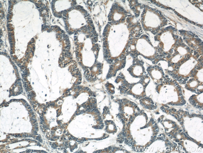 LASP1 Antibody in Immunohistochemistry (Paraffin) (IHC (P))