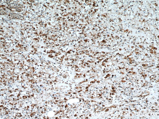 LASP1 Antibody in Immunohistochemistry (Paraffin) (IHC (P))