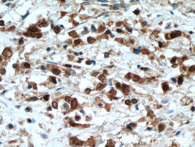 LASP1 Antibody in Immunohistochemistry (Paraffin) (IHC (P))