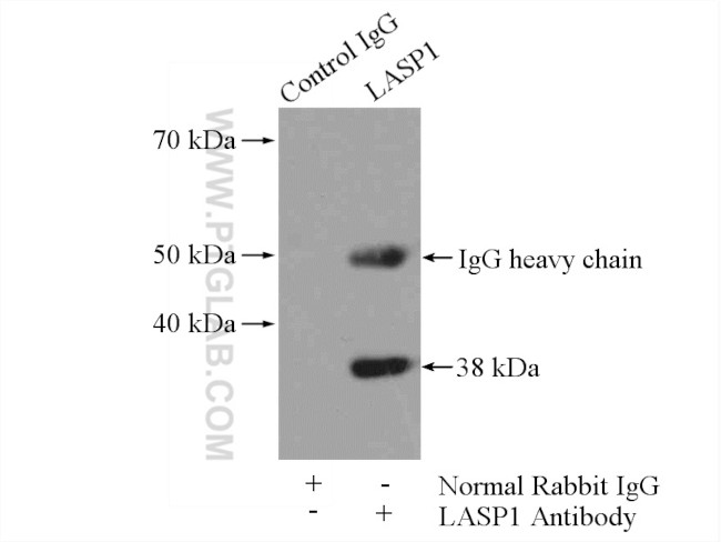 LASP1 Antibody in Immunoprecipitation (IP)