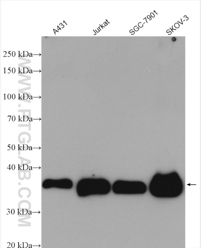 LASP1 Antibody in Western Blot (WB)