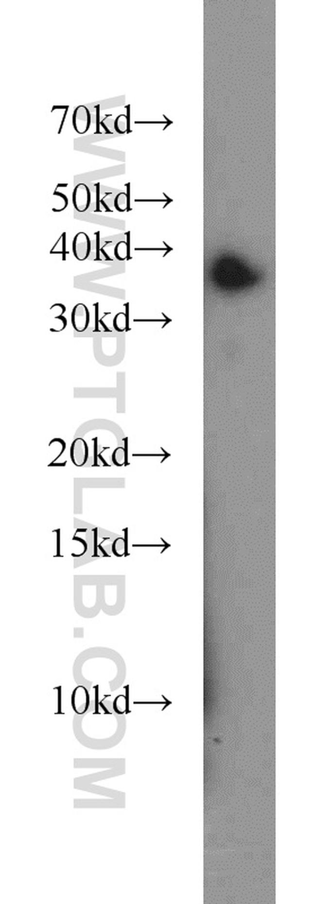 LASP1 Antibody in Western Blot (WB)