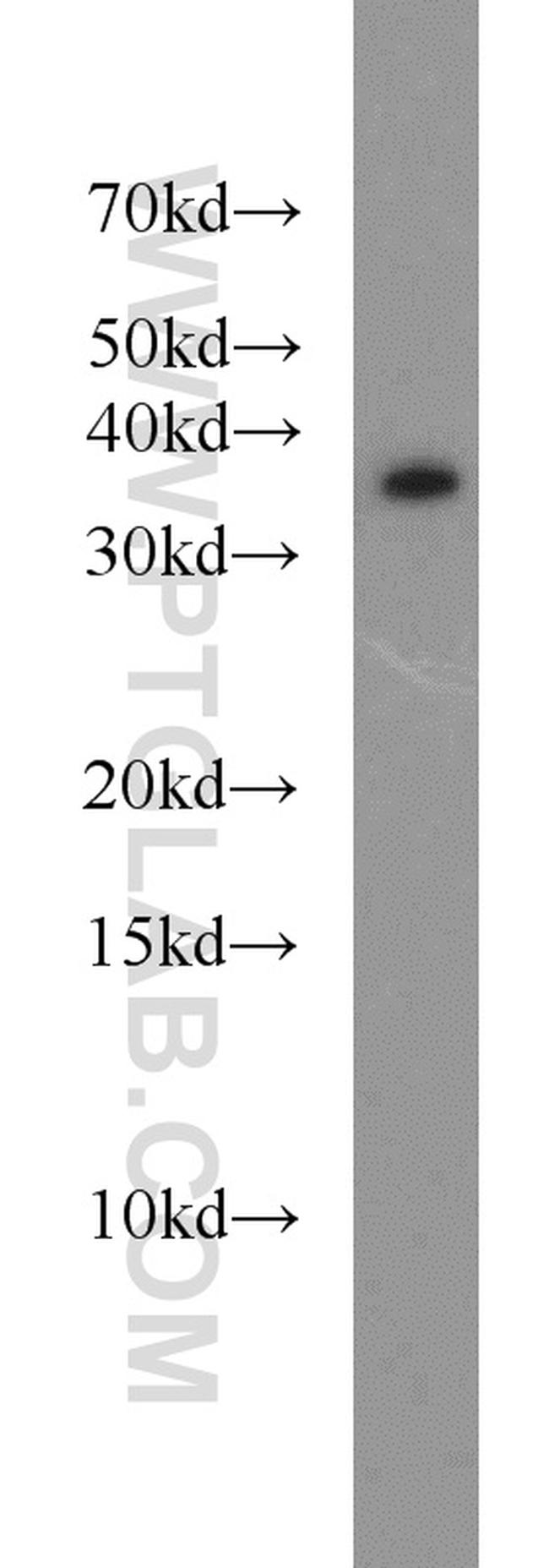 LASP1 Antibody in Western Blot (WB)