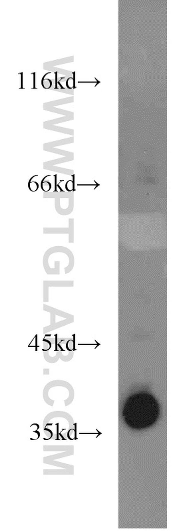 LASP1 Antibody in Western Blot (WB)