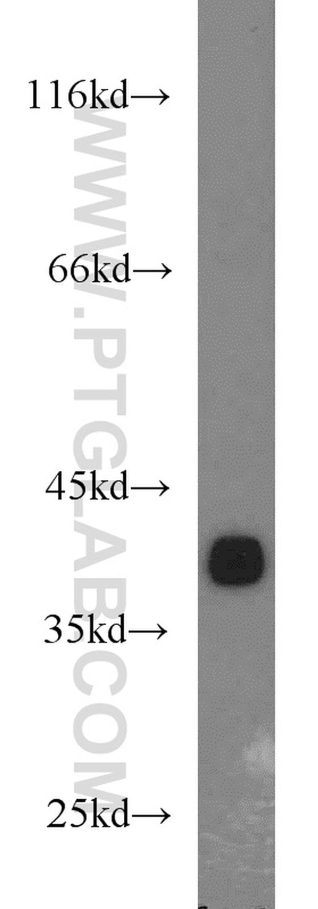 LASP1 Antibody in Western Blot (WB)