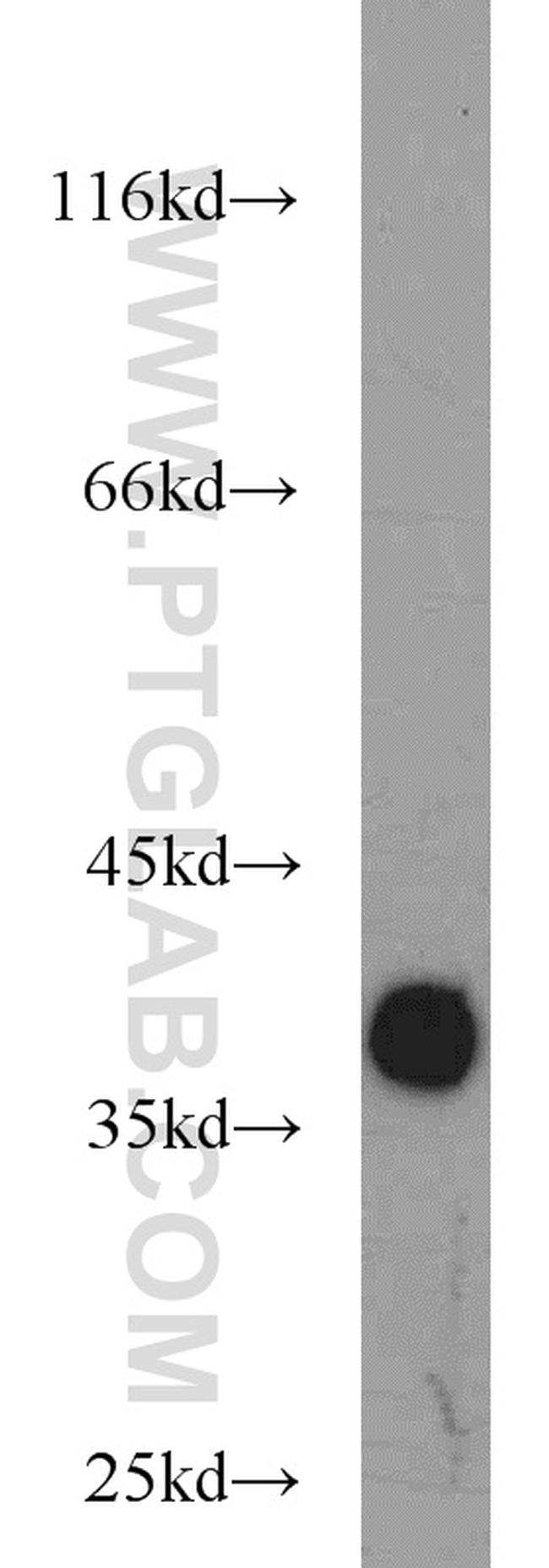 LASP1 Antibody in Western Blot (WB)