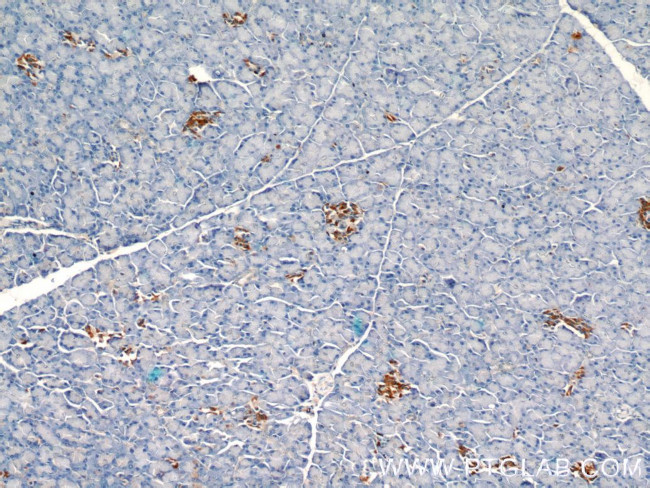 SDF4 Antibody in Immunohistochemistry (Paraffin) (IHC (P))