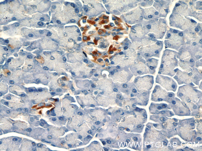 SDF4 Antibody in Immunohistochemistry (Paraffin) (IHC (P))