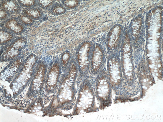 SDF4 Antibody in Immunohistochemistry (Paraffin) (IHC (P))