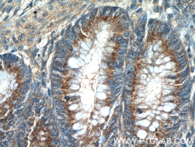 SDF4 Antibody in Immunohistochemistry (Paraffin) (IHC (P))