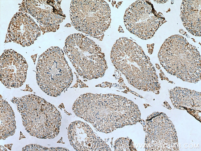 SDF4 Antibody in Immunohistochemistry (Paraffin) (IHC (P))