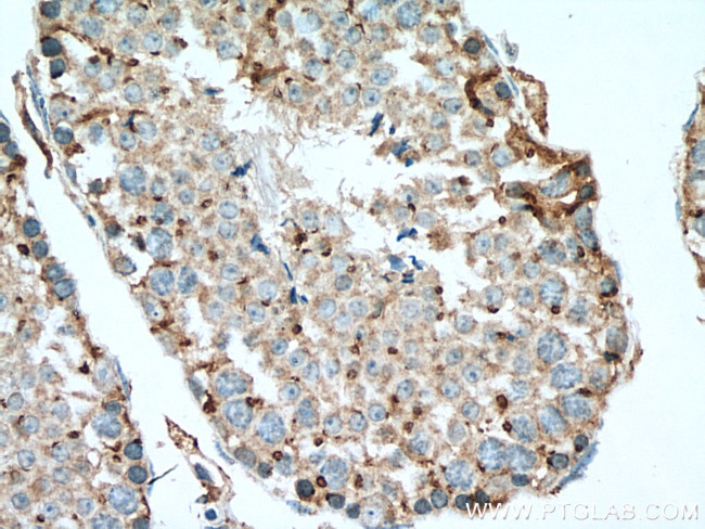 SDF4 Antibody in Immunohistochemistry (Paraffin) (IHC (P))