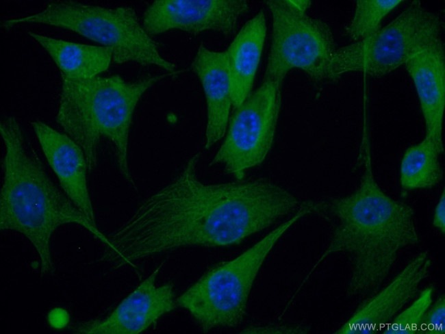 PACSIN2 Antibody in Immunocytochemistry (ICC/IF)