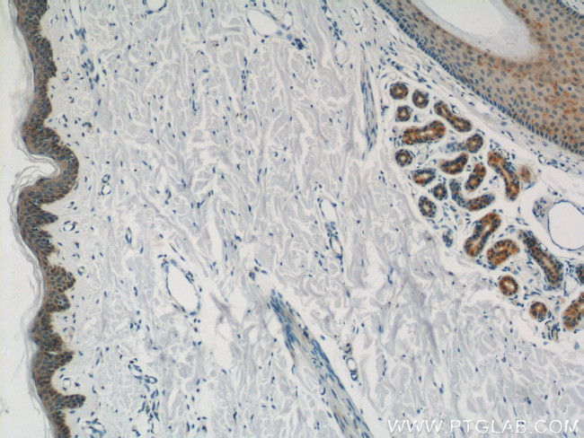 PACSIN2 Antibody in Immunohistochemistry (Paraffin) (IHC (P))