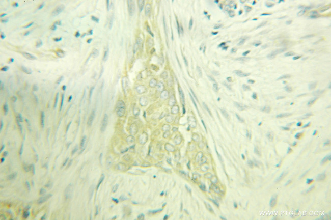 PACSIN2 Antibody in Immunohistochemistry (Paraffin) (IHC (P))