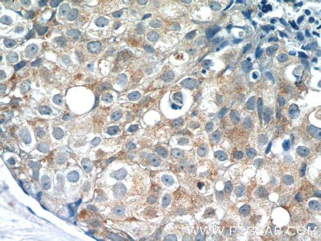 PACSIN2 Antibody in Immunohistochemistry (Paraffin) (IHC (P))