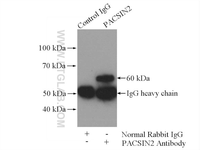 PACSIN2 Antibody in Immunoprecipitation (IP)