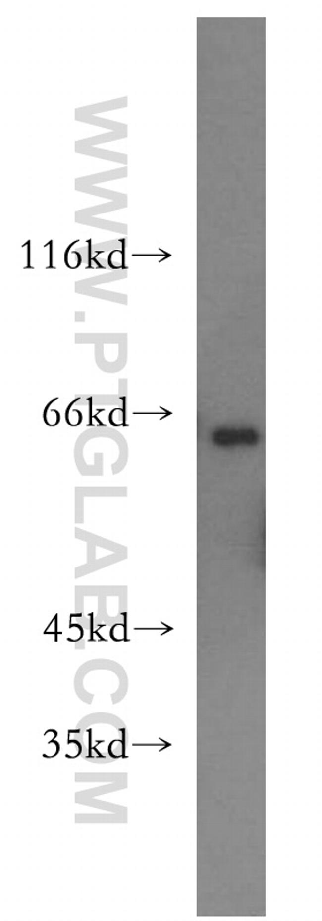 PACSIN2 Antibody in Western Blot (WB)