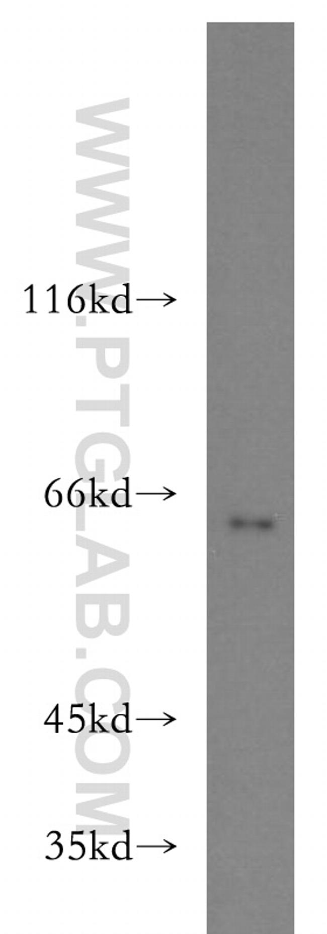 PACSIN2 Antibody in Western Blot (WB)