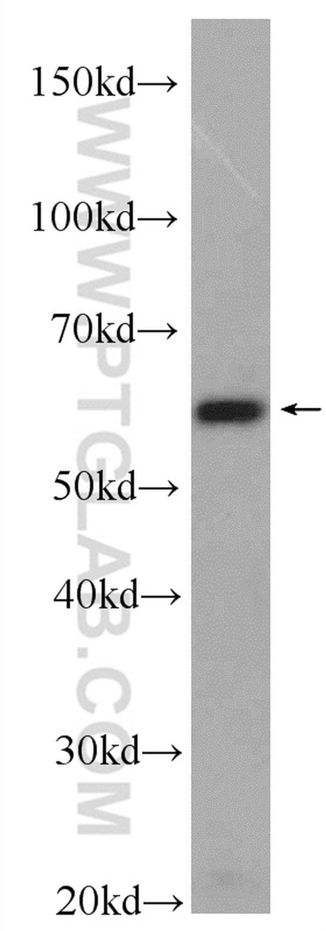 PACSIN2 Antibody in Western Blot (WB)