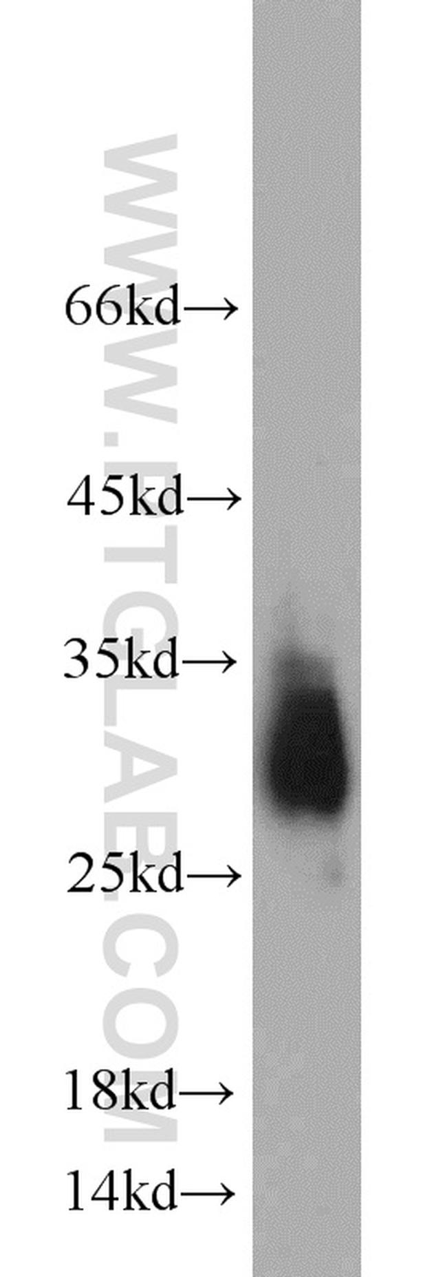 APOD Antibody in Western Blot (WB)