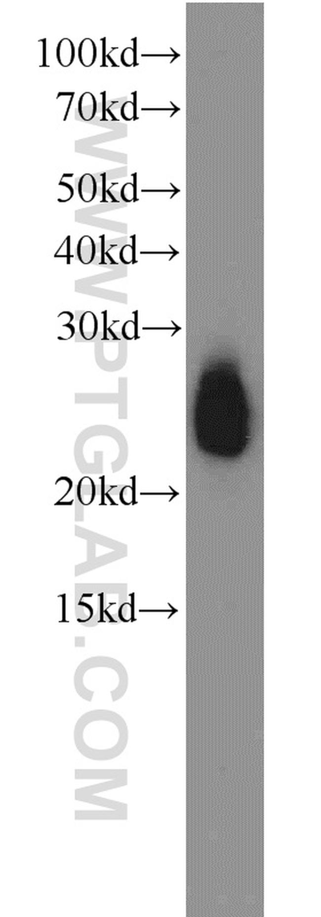 APOD Antibody in Western Blot (WB)