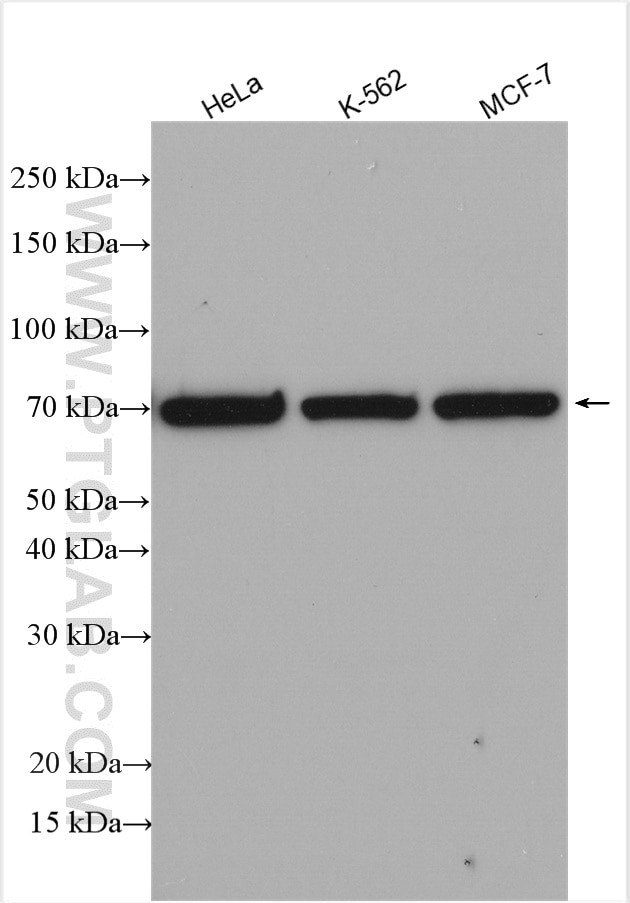 IFNAR2 Antibody in Western Blot (WB)