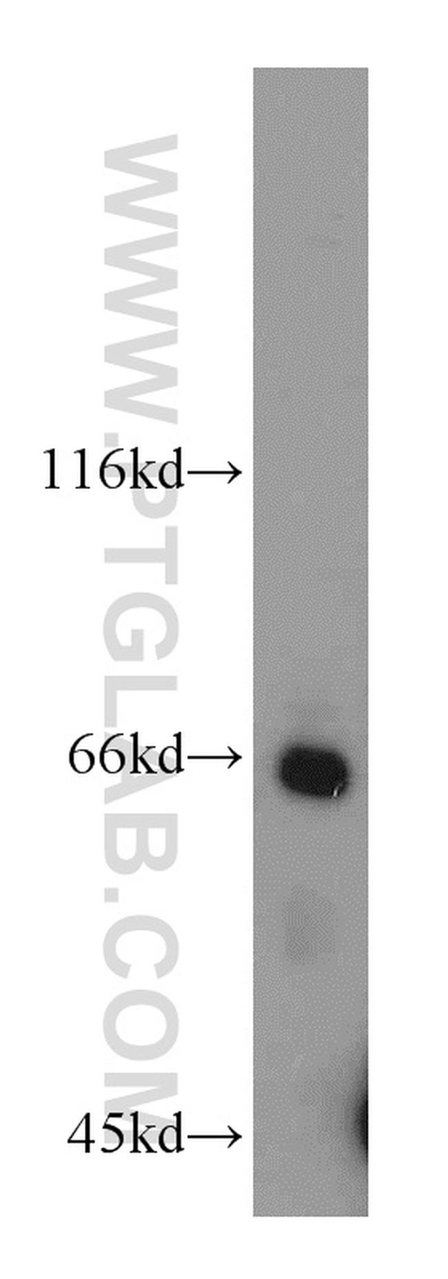 IFNAR2 Antibody in Western Blot (WB)