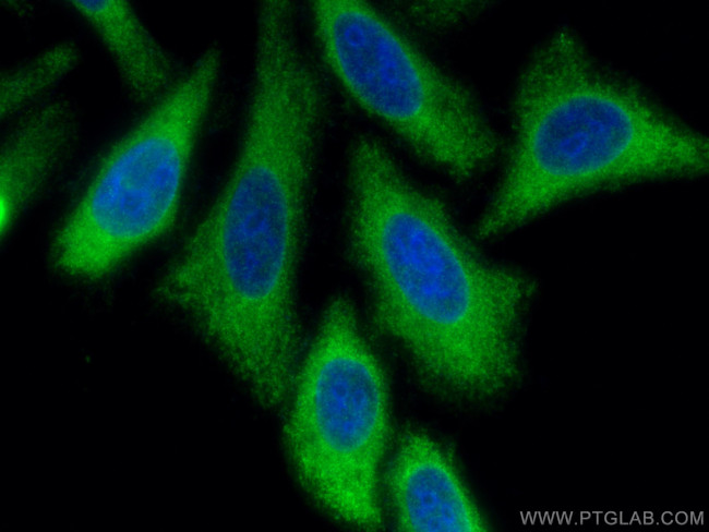 RRM1 Antibody in Immunocytochemistry (ICC/IF)