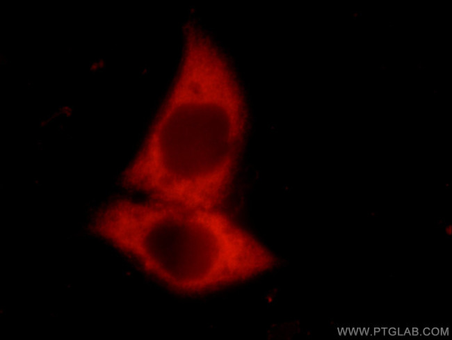 RRM1 Antibody in Immunocytochemistry (ICC/IF)