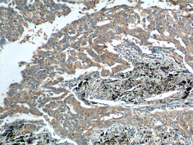 RRM1 Antibody in Immunohistochemistry (Paraffin) (IHC (P))