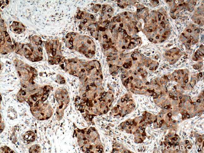 RRM1 Antibody in Immunohistochemistry (Paraffin) (IHC (P))