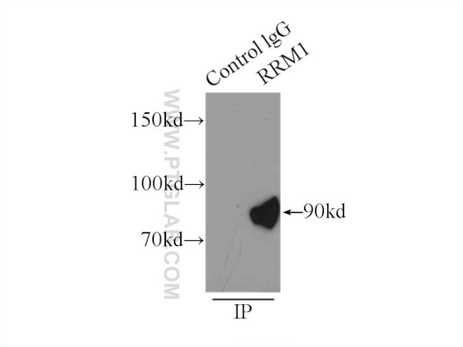 RRM1 Antibody in Immunoprecipitation (IP)
