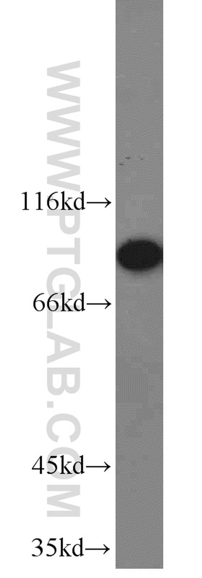 RRM1 Antibody in Western Blot (WB)