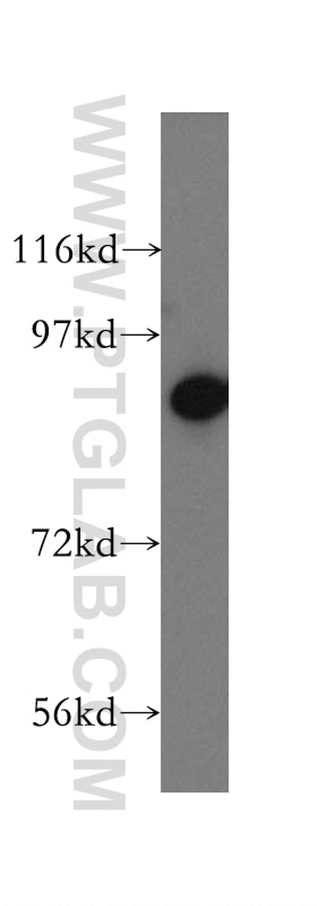 RRM1 Antibody in Western Blot (WB)