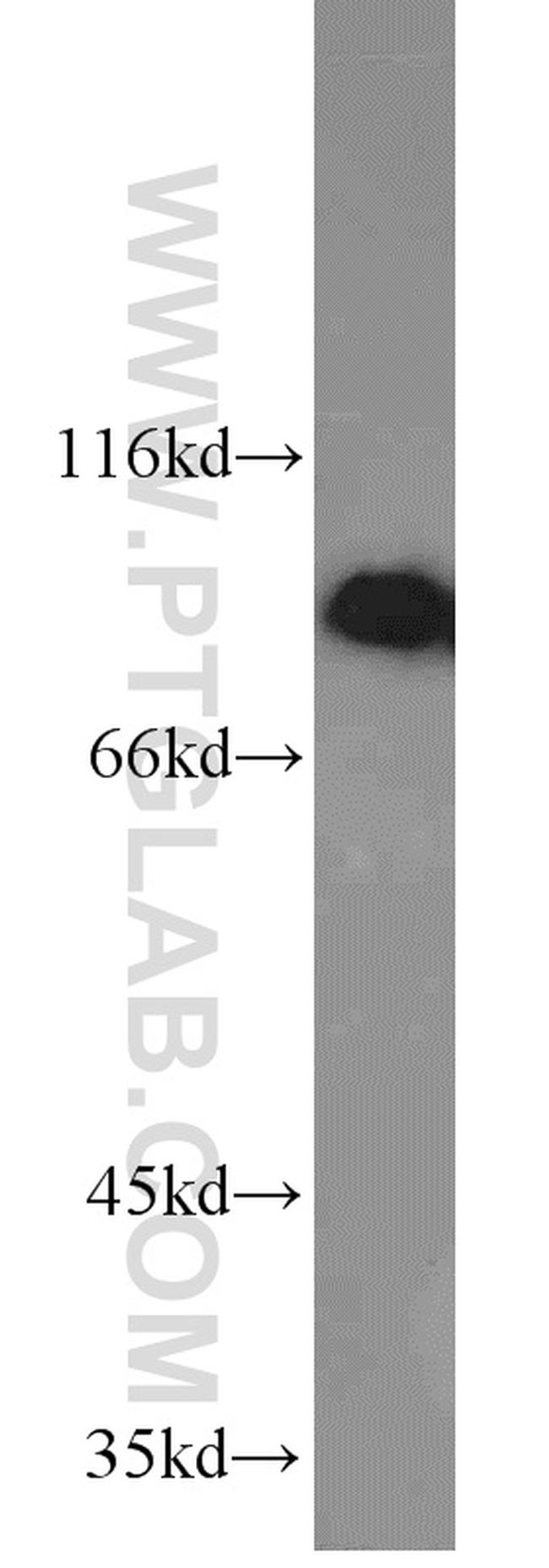 RRM1 Antibody in Western Blot (WB)