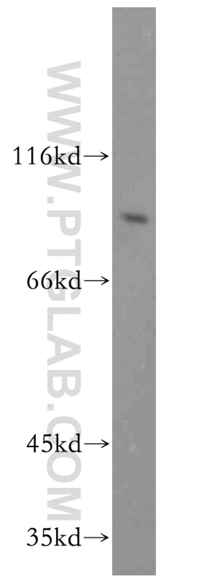 RRM1 Antibody in Western Blot (WB)