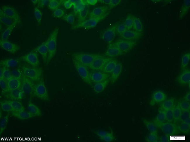 NRG1 Antibody in Immunocytochemistry (ICC/IF)