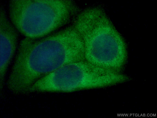 NRG1 Antibody in Immunocytochemistry (ICC/IF)