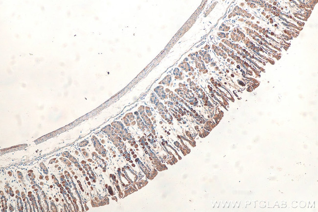 NRG1 Antibody in Immunohistochemistry (Paraffin) (IHC (P))